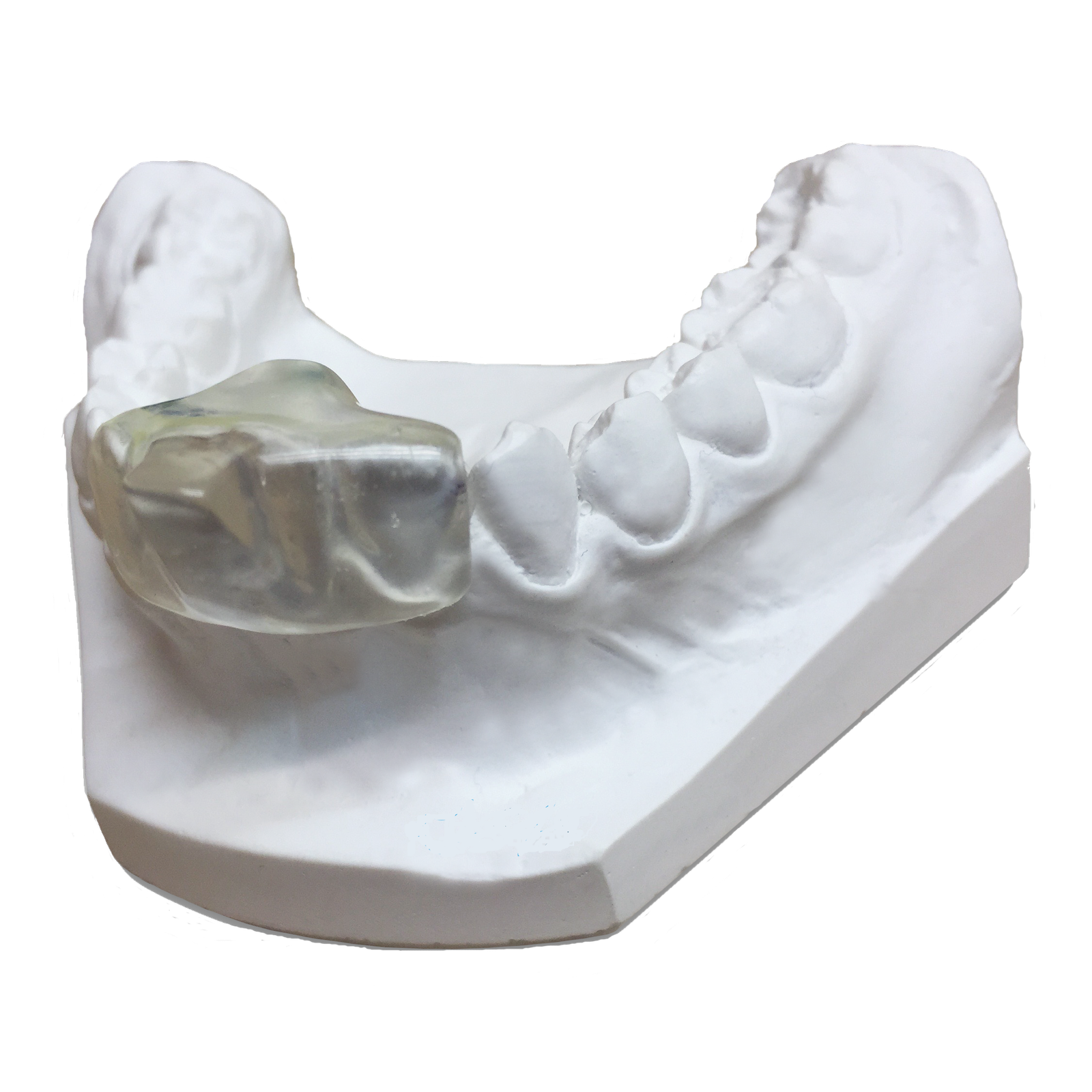 Bruxism Device
